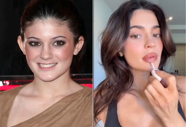 Kylie Jenner antes y después