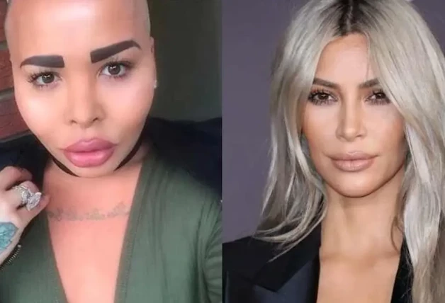 Jordan James Parke se dio a conocer a través de los medios de comunicación por las múltiples cirugías plásticas a las que se sometió para parecerse físicamente a la famosa Kim Kardashian.