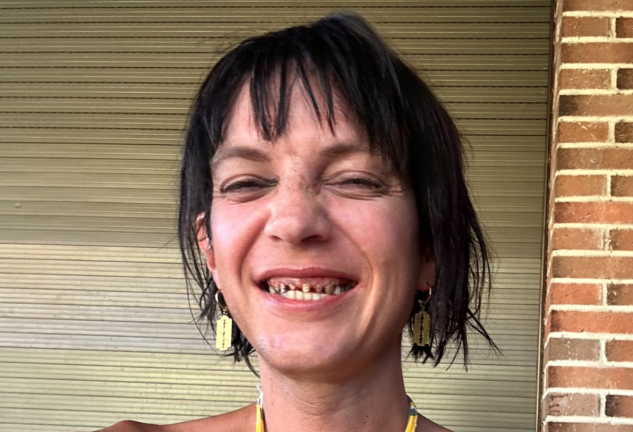 Sheila Devil, su preocupante dentadura.