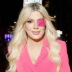 Tori Spelling lleva un parche en el ojo.