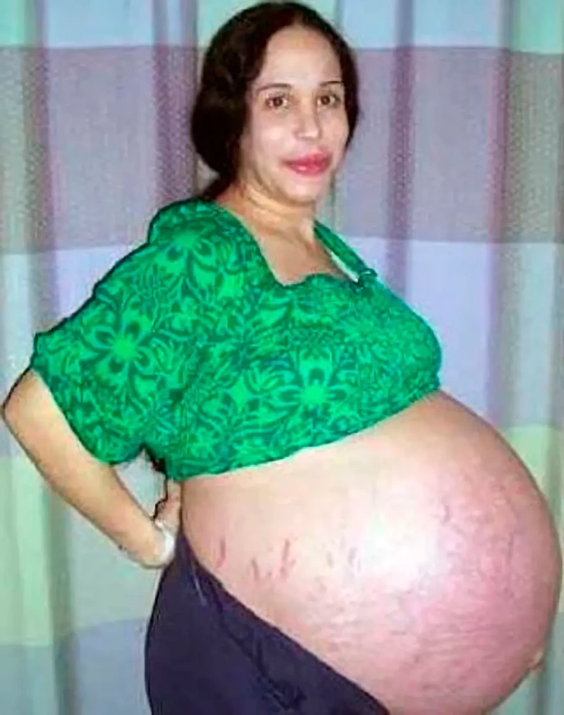 Nadya Suleman cuando estaba embarazada de sus octillizos.