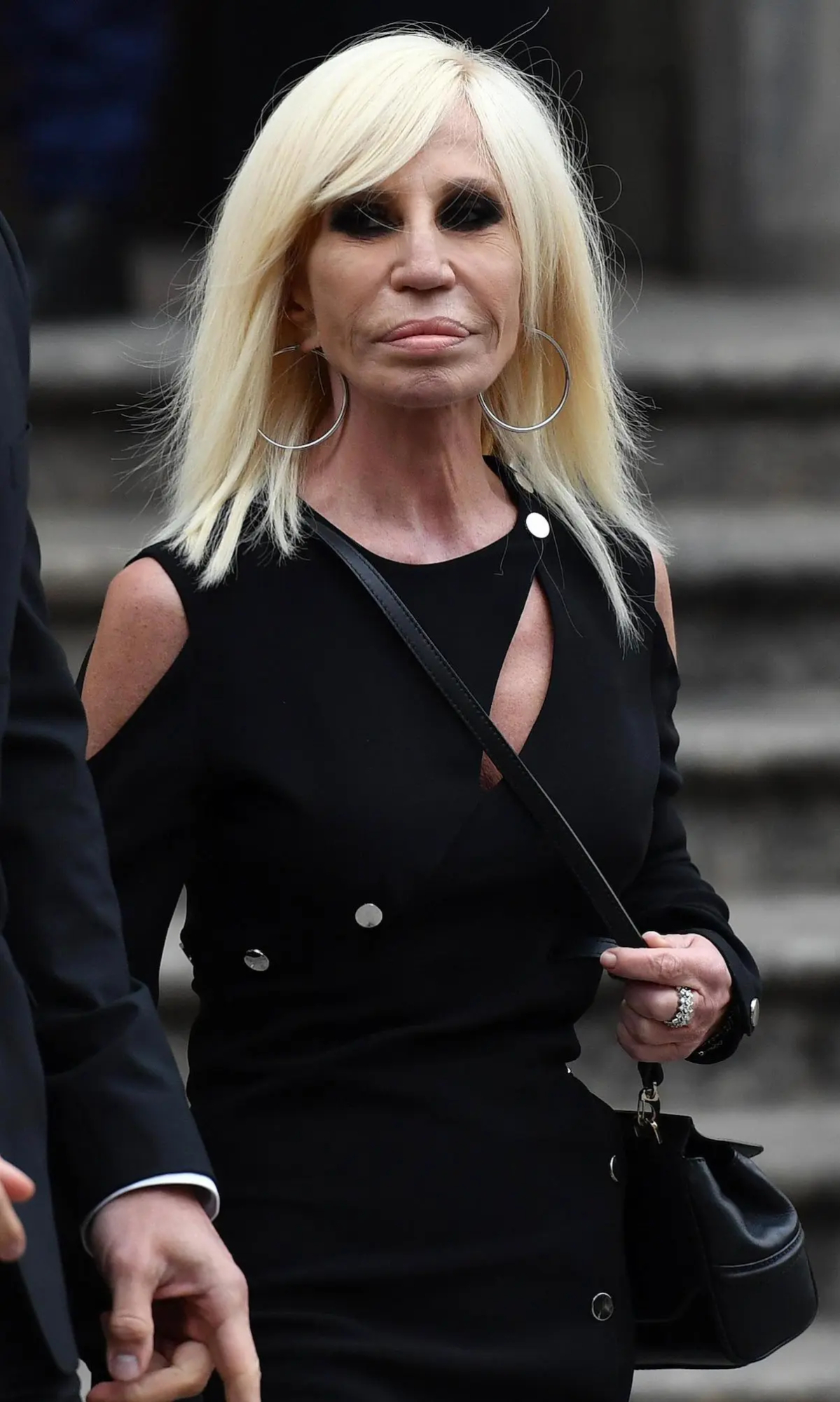 Donatella Versace operaciones