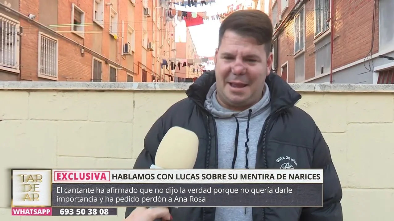 Lucas, de Andy y Lucas, habla sobre su nariz en 'TardeAR'.