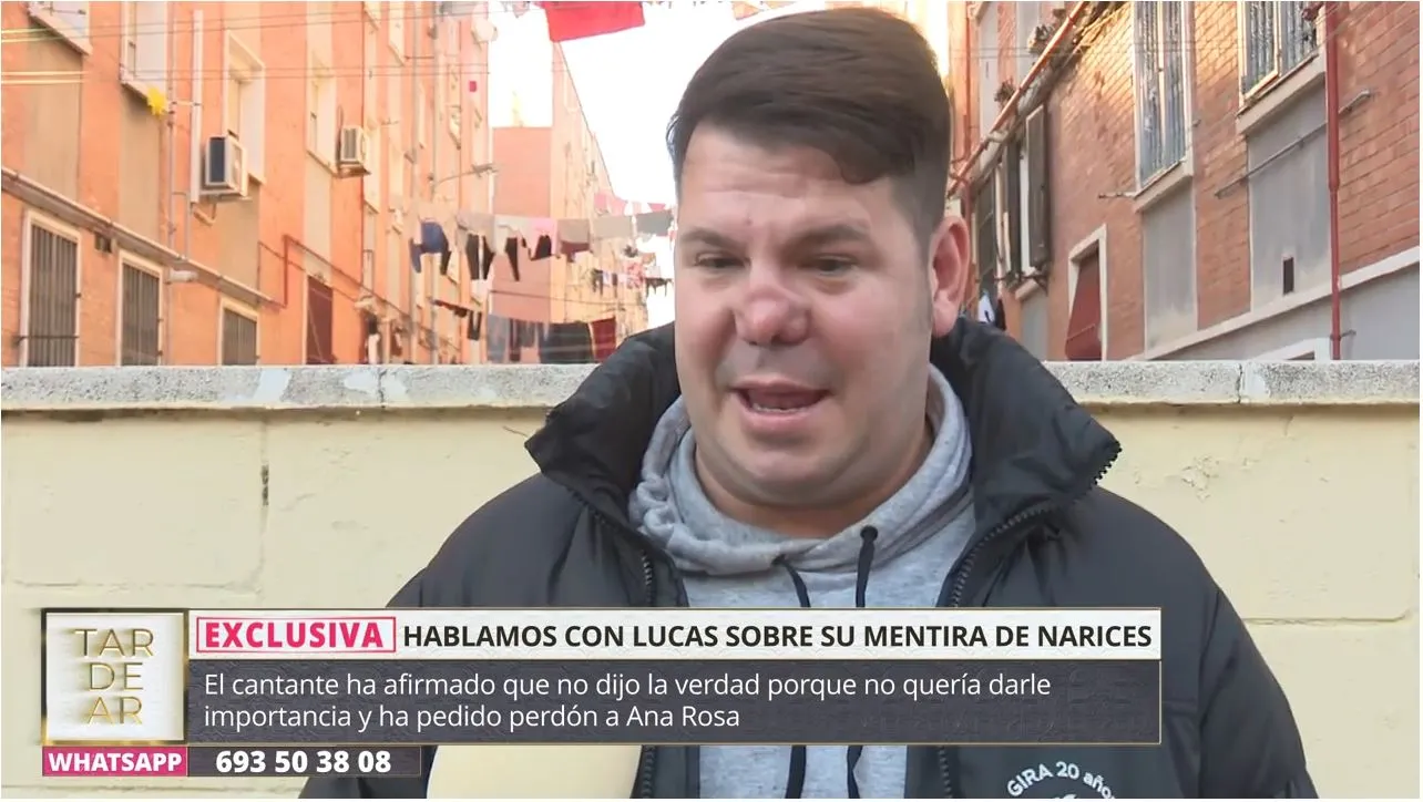 Lucas, de Andy y Lucas, habla sobre su nariz en 'TardeAR'.