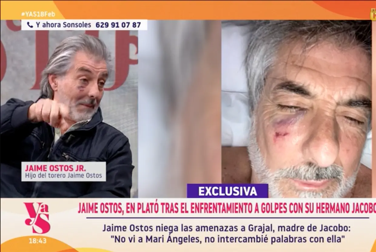 Jaime Ostos Jr. mostrando sus lesiones en televisión.