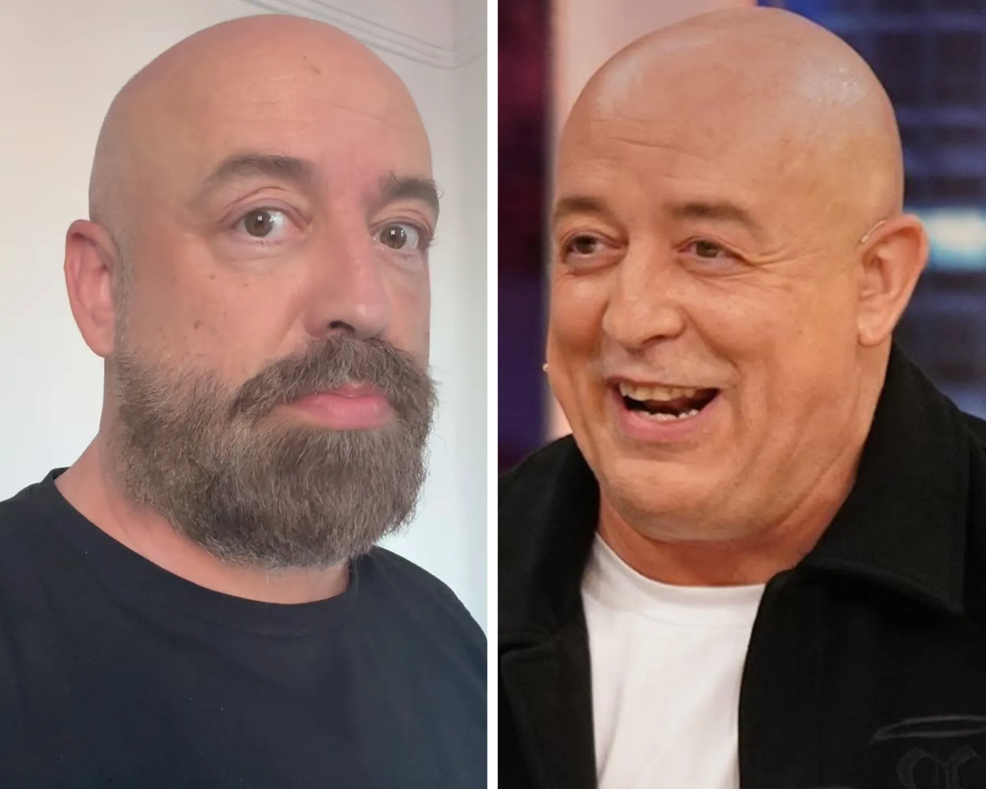 Goyo Jiménez en una comparativa con y sin barba (Redes/El Hormiguero).